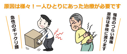 腰痛・ギックリ腰の鍼灸治療